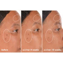 Before and After Results After Using Vitamin C +E + Ferulic Brightening Face Serum